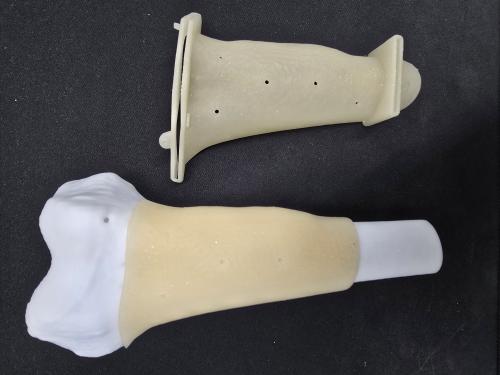 정형외과용 임플란트