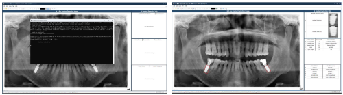 와치덴트(WatchDent)