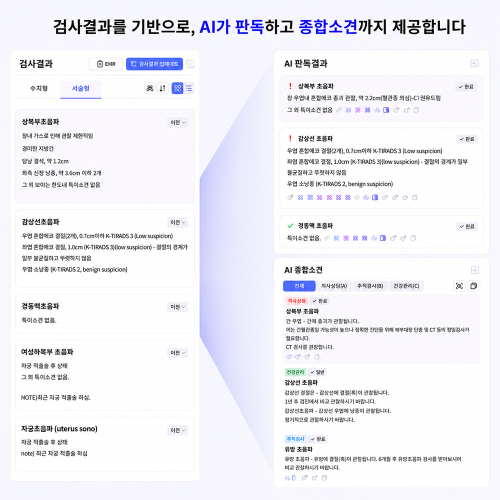 하이라이트