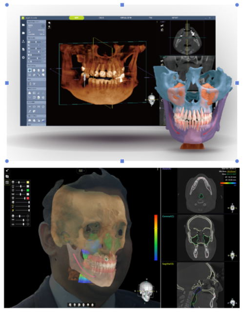 Dentium 3D Viewer
